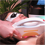 光フェイシャル